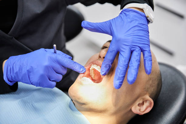 Best Emergency Tooth Extraction in Colonial Pine Hills, SD